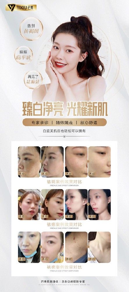 我想开个已秀减肥店 济南纤体减肥加盟店